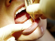 Signs Of Gum Disease