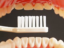 poor oral hygiene